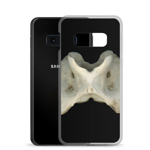 Samsung Case | White-tailed Deer Atlas Vertebra by Matteo