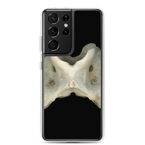 Samsung Case | White-tailed Deer Atlas Vertebra by Matteo